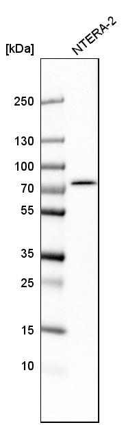 Atlas Antibodies Anti-TBC1D15 Antibody