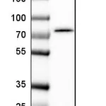 Atlas Antibodies Anti-TBC1D15 Antibody