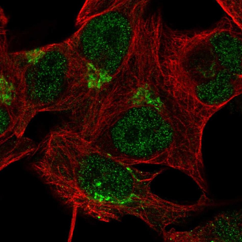 Atlas Antibodies Anti-TBC1D14 Antibody