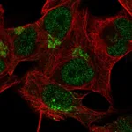 Atlas Antibodies Anti-TBC1D14 Antibody