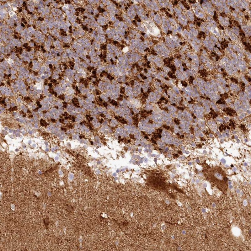 Atlas Antibodies Anti-TBC1D14 Antibody