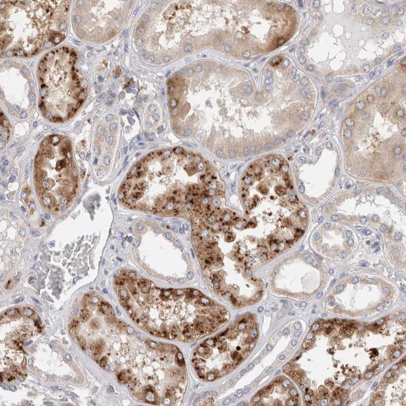 Atlas Antibodies Anti-TBC1D16 Antibody