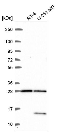 Atlas Antibodies Anti-TBC1D16 Antibody