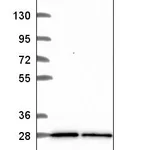 Atlas Antibodies Anti-TBC1D16 Antibody