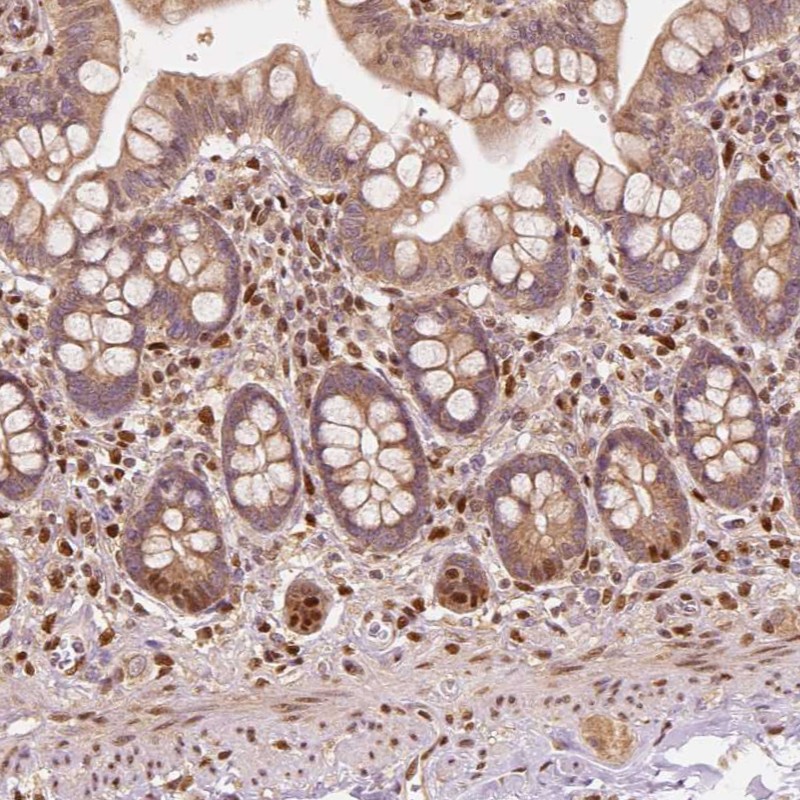 Atlas Antibodies Anti-TBC1D17 Antibody