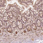 Atlas Antibodies Anti-TBC1D17 Antibody