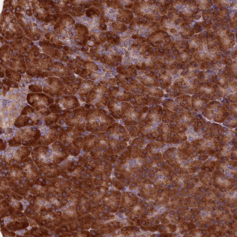 Atlas Antibodies Anti-TBC1D19 Antibody