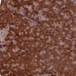 Atlas Antibodies Anti-TBC1D19 Antibody
