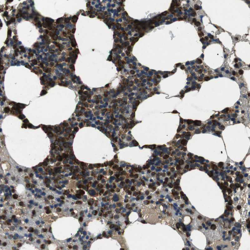 Atlas Antibodies Anti-TBC1D15 Antibody