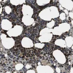 Atlas Antibodies Anti-TBC1D15 Antibody