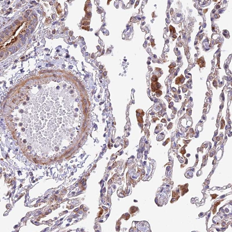 Atlas Antibodies Anti-TBC1D20 Antibody