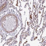 Atlas Antibodies Anti-TBC1D20 Antibody