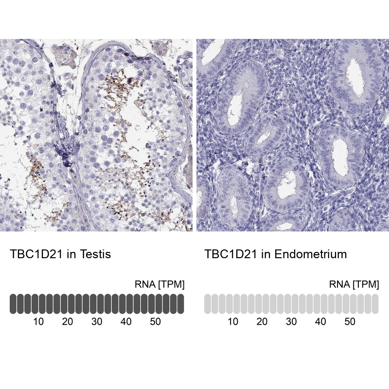 Atlas Antibodies Anti-TBC1D21 Antibody