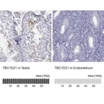 Atlas Antibodies Anti-TBC1D21 Antibody