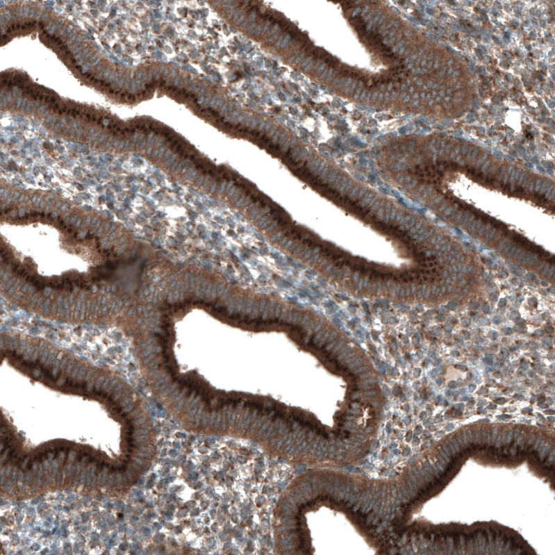 Atlas Antibodies Anti-TBC1D23 Antibody