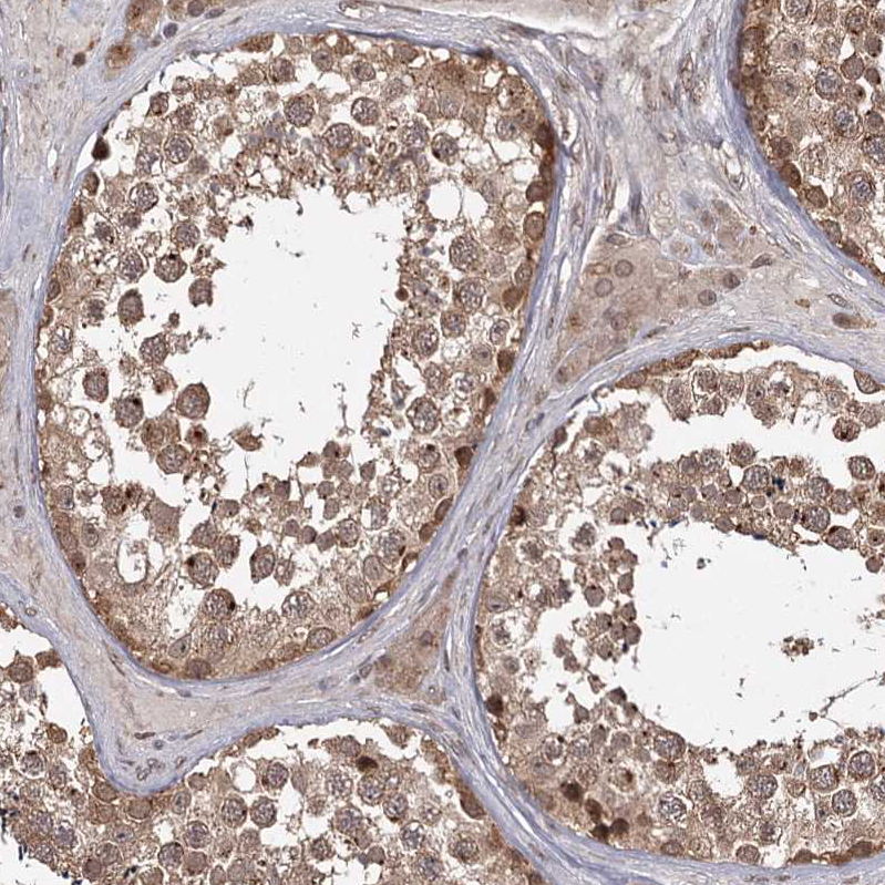 Atlas Antibodies Anti-TBC1D23 Antibody