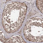 Atlas Antibodies Anti-TBC1D23 Antibody