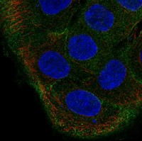 Atlas Antibodies Anti-TBC1D2 Antibody