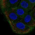 Atlas Antibodies Anti-TBC1D2 Antibody