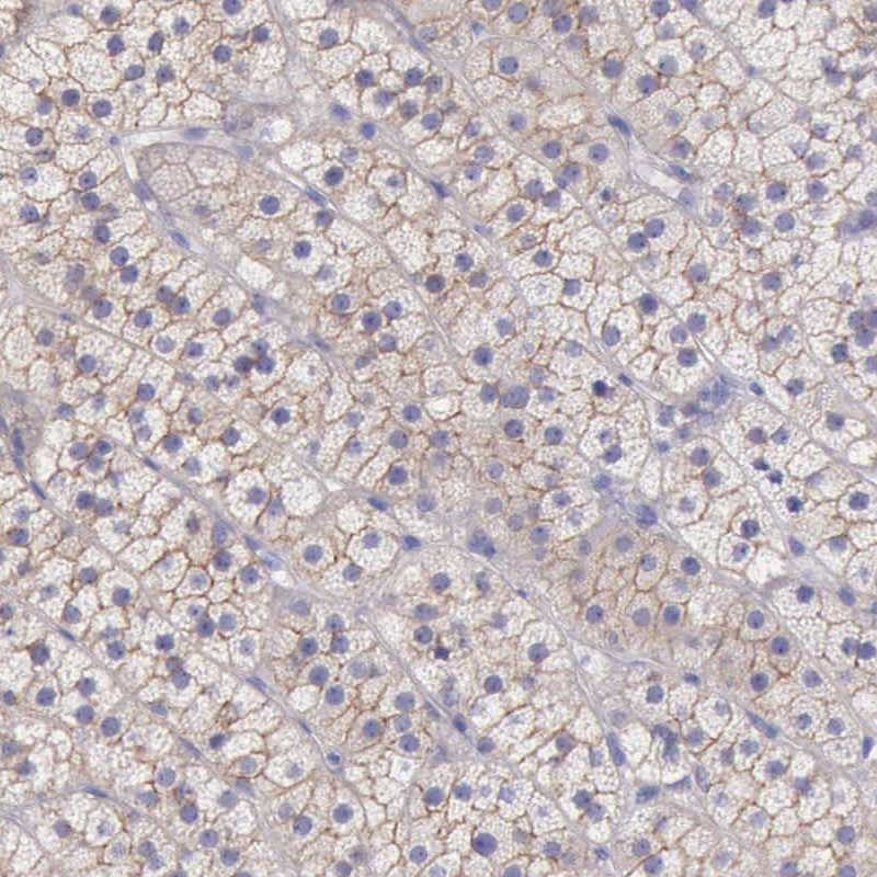 Atlas Antibodies Anti-TBC1D22A Antibody