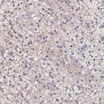Atlas Antibodies Anti-TBC1D22A Antibody