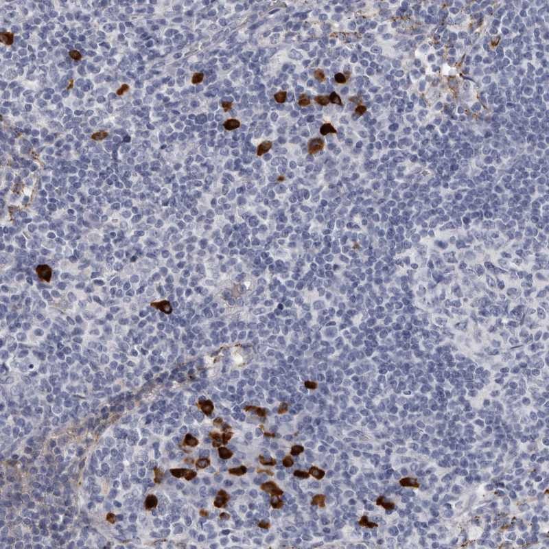 Atlas Antibodies Anti-TBC1D22B Antibody