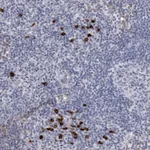 Atlas Antibodies Anti-TBC1D22B Antibody