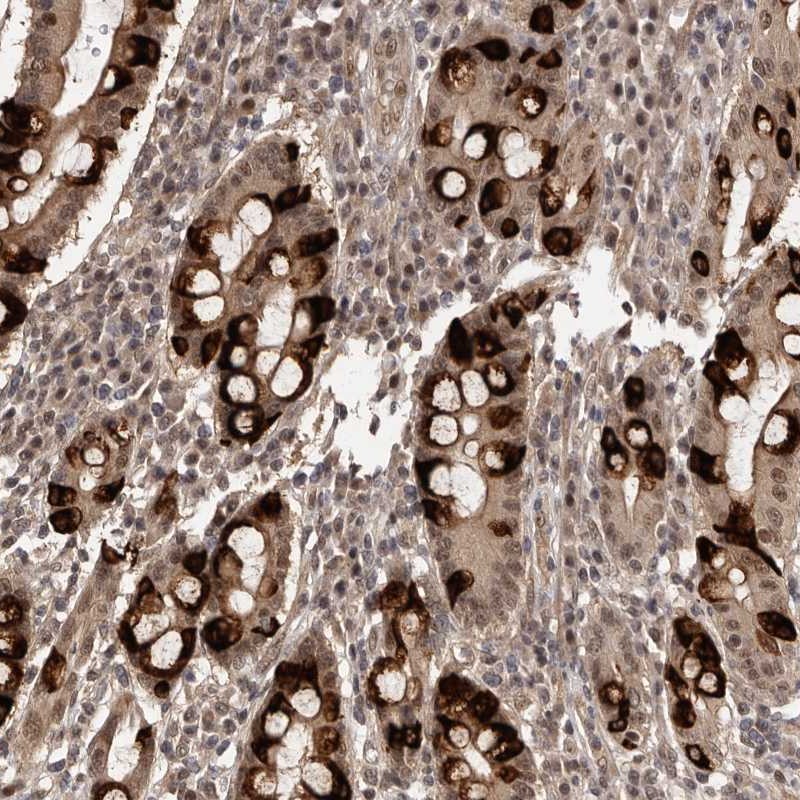 Atlas Antibodies Anti-TBC1D22B Antibody