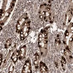 Atlas Antibodies Anti-TBC1D22B Antibody