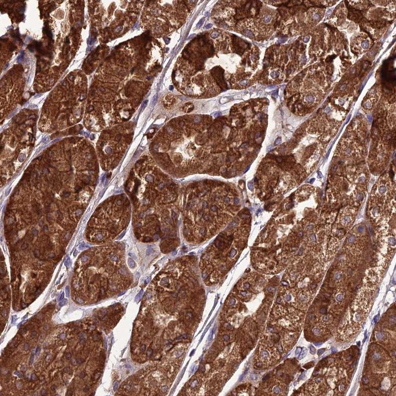 Atlas Antibodies Anti-TBC1D24 Antibody
