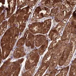 Atlas Antibodies Anti-TBC1D24 Antibody