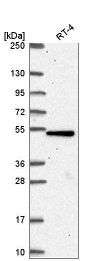 Atlas Antibodies Anti-TBC1D24 Antibody