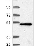 Atlas Antibodies Anti-TBC1D24 Antibody