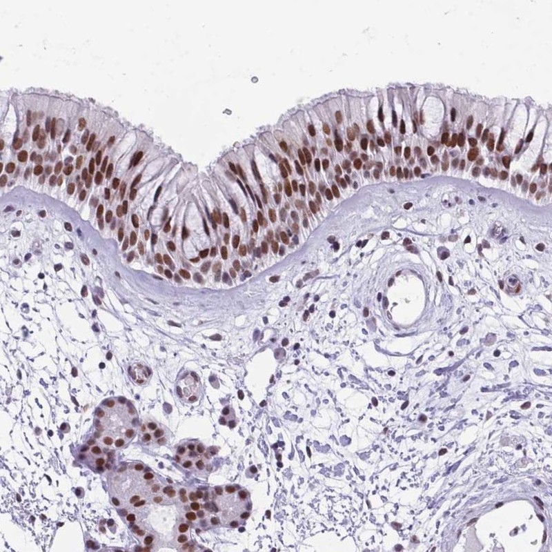 Atlas Antibodies Anti-TBC1D26 Antibody