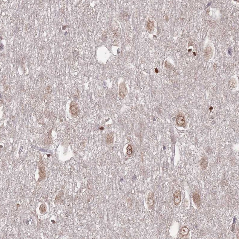 Atlas Antibodies Anti-TBC1D25 Antibody