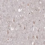 Atlas Antibodies Anti-TBC1D25 Antibody