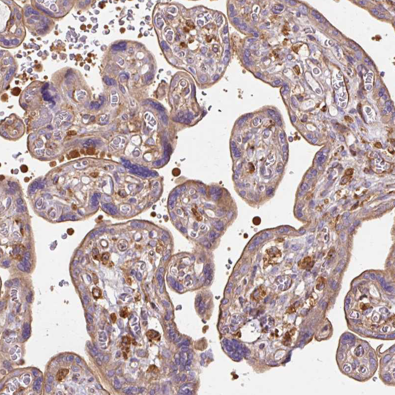 Atlas Antibodies Anti-TBC1D2B Antibody