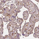 Atlas Antibodies Anti-TBC1D2B Antibody