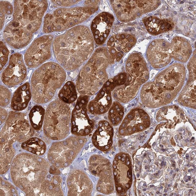Atlas Antibodies Anti-TBC1D30 Antibody