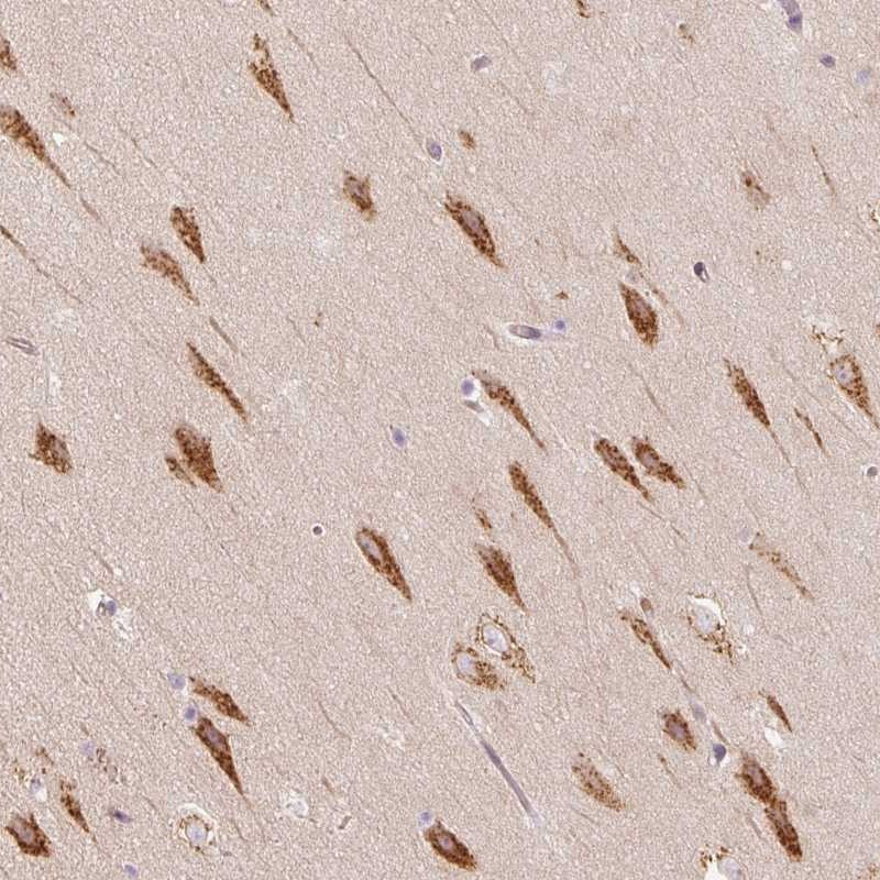 Atlas Antibodies Anti-TBC1D2B Antibody