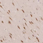 Atlas Antibodies Anti-TBC1D2B Antibody