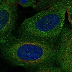 Atlas Antibodies Anti-TBC1D2B Antibody