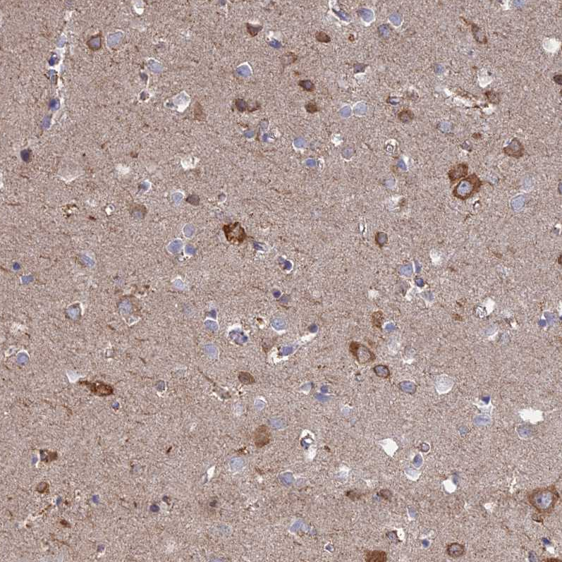 Atlas Antibodies Anti-TBC1D30 Antibody