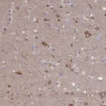 Atlas Antibodies Anti-TBC1D30 Antibody