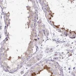 Atlas Antibodies Anti-TBC1D3L Antibody