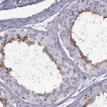 Atlas Antibodies Anti-TBC1D3C Antibody