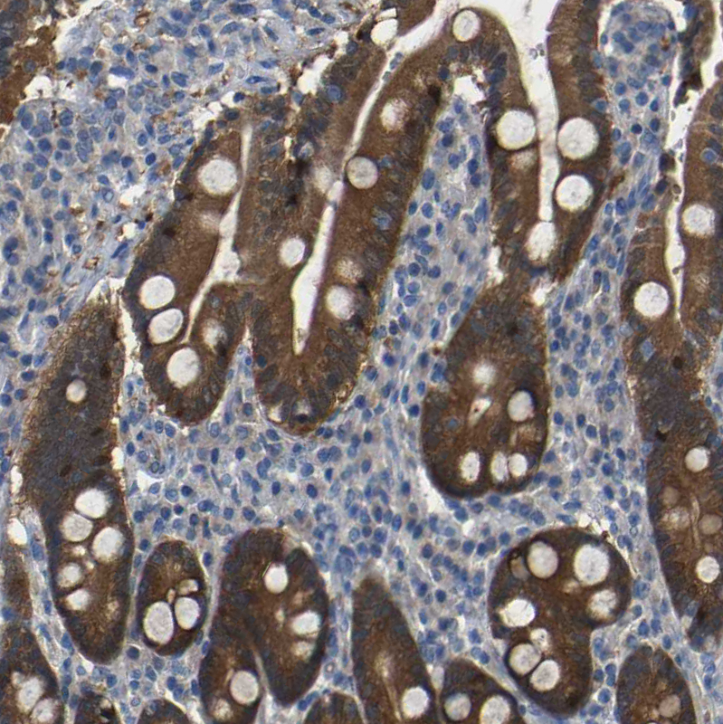 Atlas Antibodies Anti-TBC1D32 Antibody