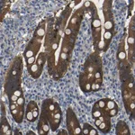 Atlas Antibodies Anti-TBC1D32 Antibody
