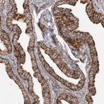Atlas Antibodies Anti-TBC1D5 Antibody