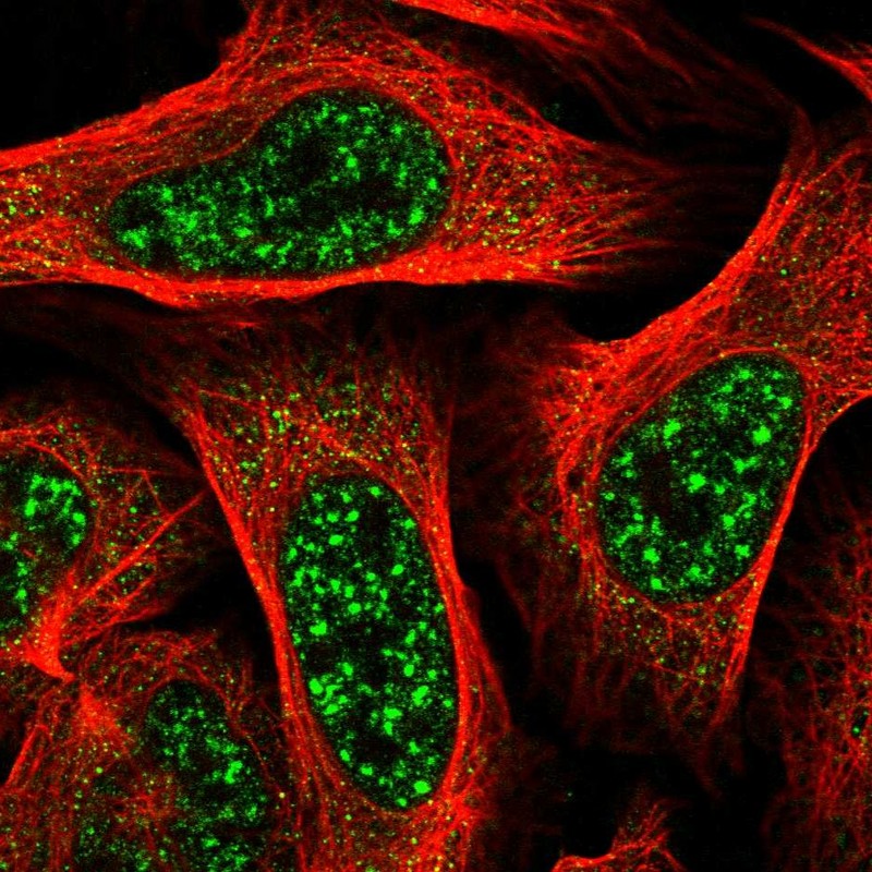 Atlas Antibodies Anti-TBC1D8 Antibody